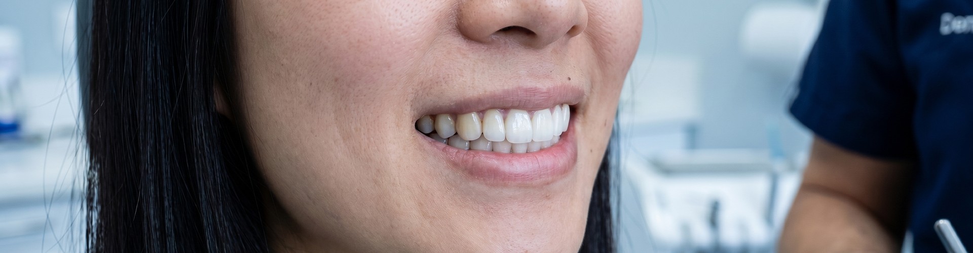 Photo of woman's smile.